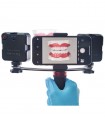 کیت نور دندانپزشکی اسینو مدل OSiNO dental twin light