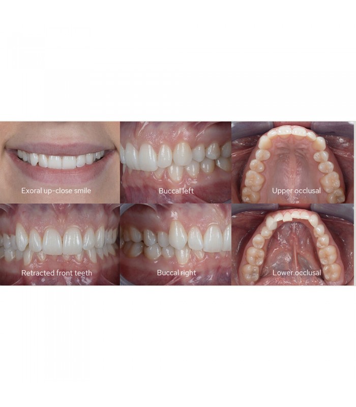 کیت فلاش ماکرو گودکس  مدل Godox MF12-DK3 Dental Macro Flash Kit