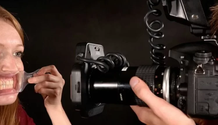 عکاسی دندانپزشکی