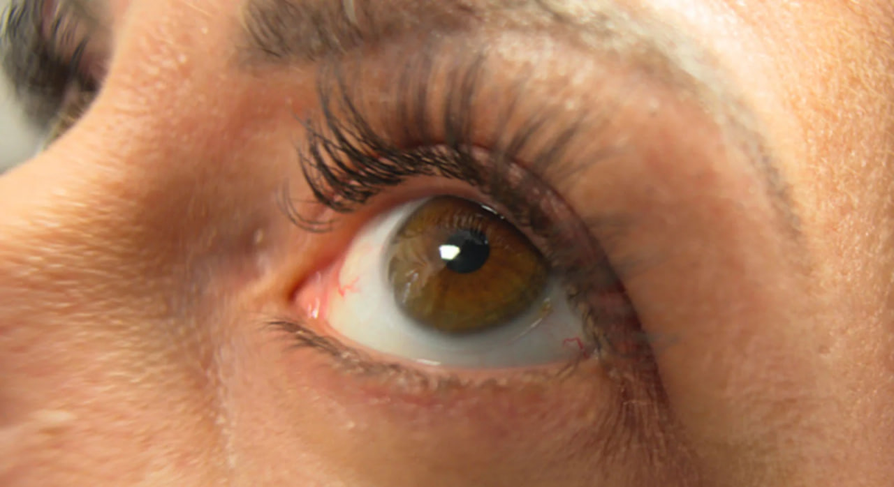 Zeiss Standard Speed